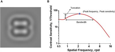 Impact of Temporal Visual Flicker on Spatial Contrast Sensitivity in Myopia